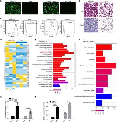 EBV-Induced CXCL8 Upregulation Promotes Vasculogenic Mimicry in Gastric Carcinoma via NF-κB Signaling